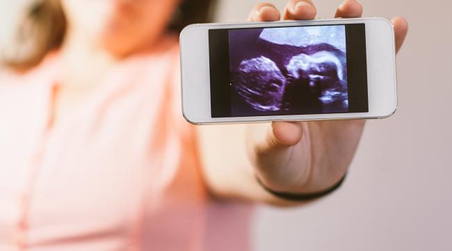 孕妇玩手机,会致胎儿畸形吗